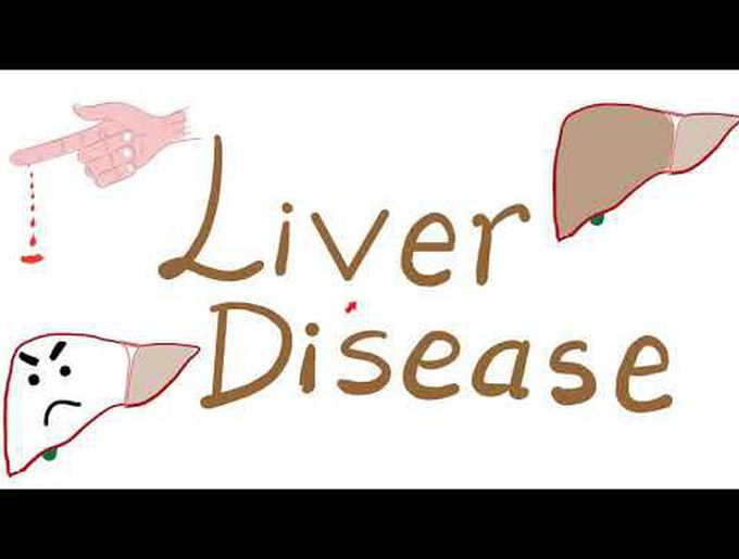 Liver Disease and Hemostasis Disorders