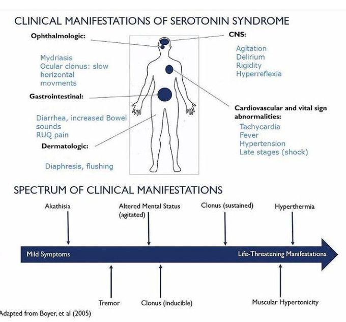 Serotonin Syndrome-Clinical Manifestations