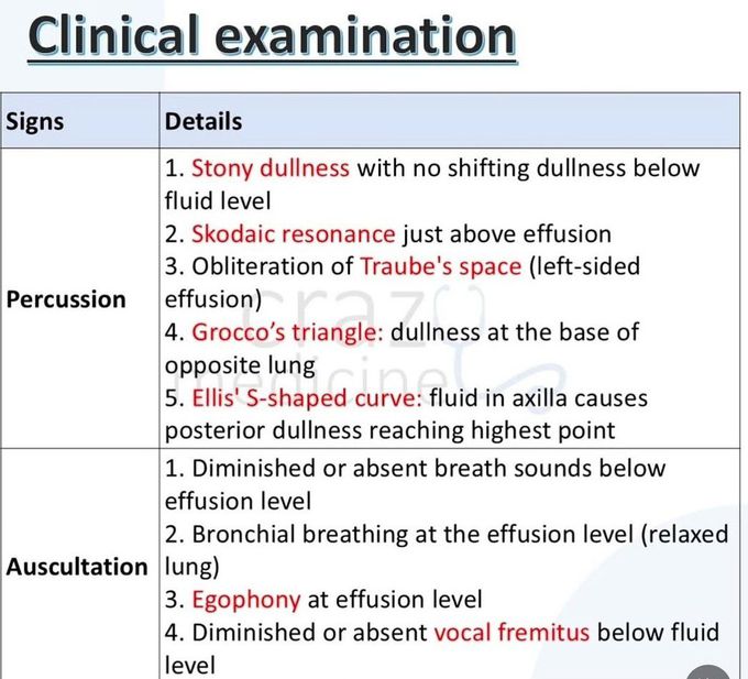 Pleural Effusion IX