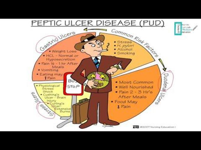 Peptic Ulcer Disease - Gastric Pharmacology