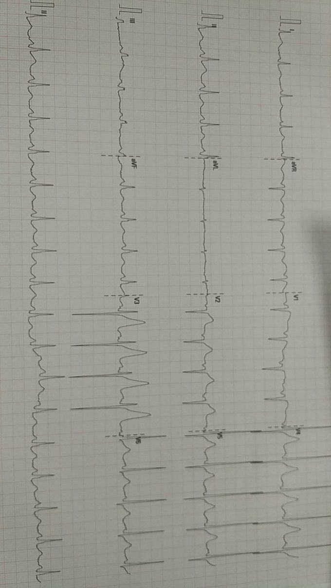Diagnosis?