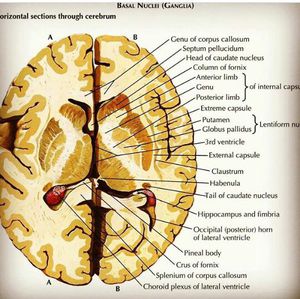 Brain - MEDizzy