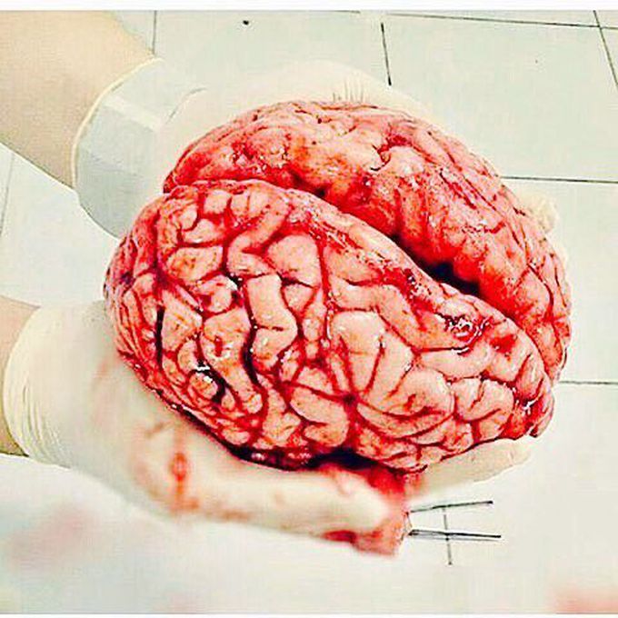 Brain, The Mysterious creation