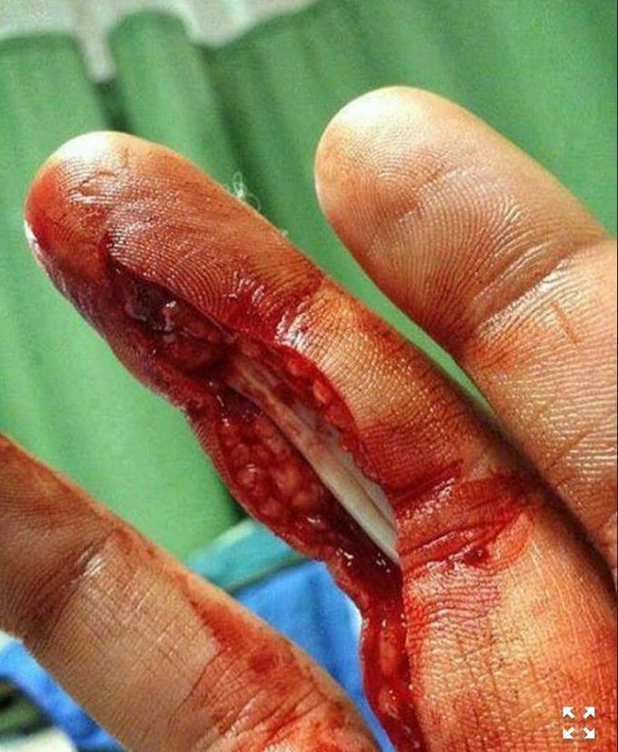 orthopedic surgery