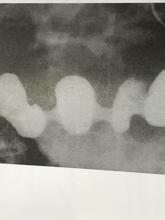 What is the diagnosis of this patient ?? 🤔