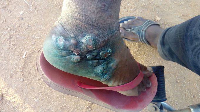 Whats your diagnosis
