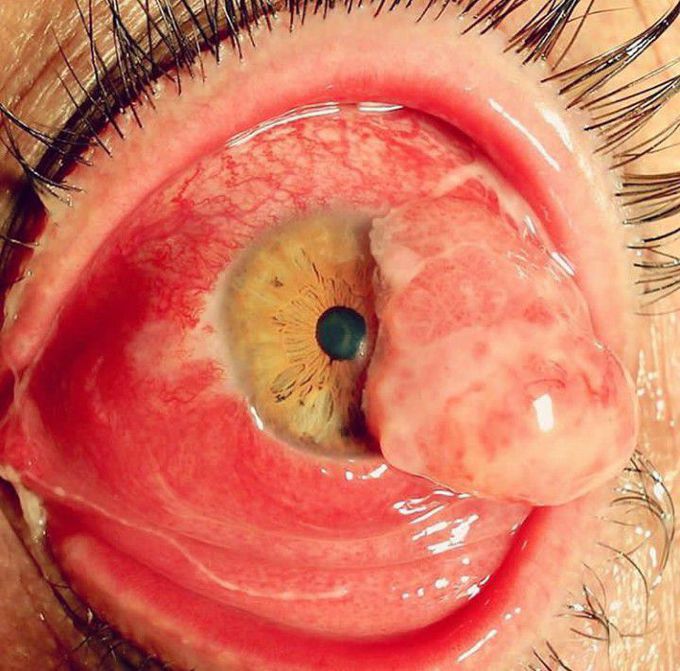 What is the Diagnosis ???