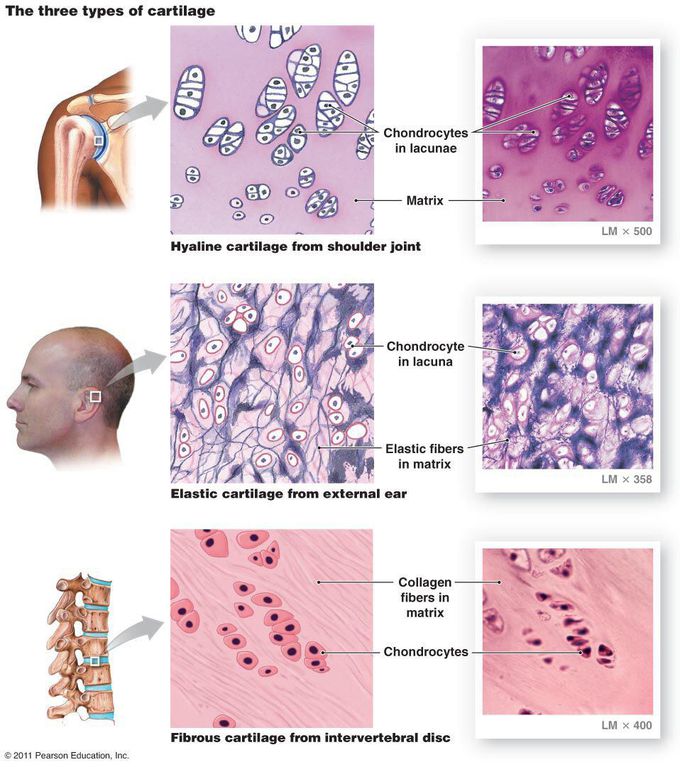 Different types of cartilage