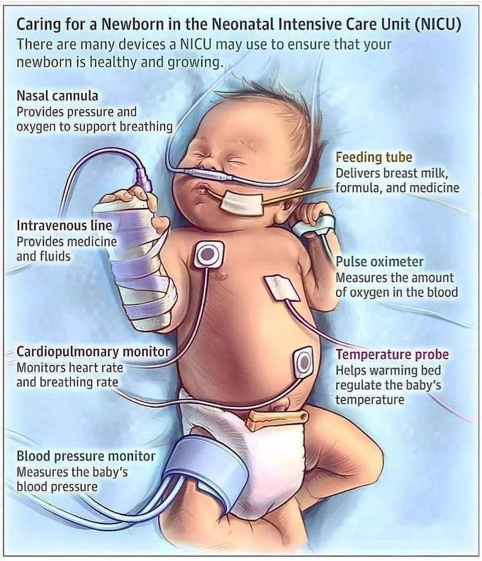 Neonatal intensive Care Unit
