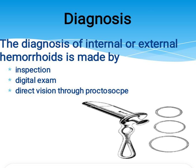 Diagnosis of Hemorrhoids