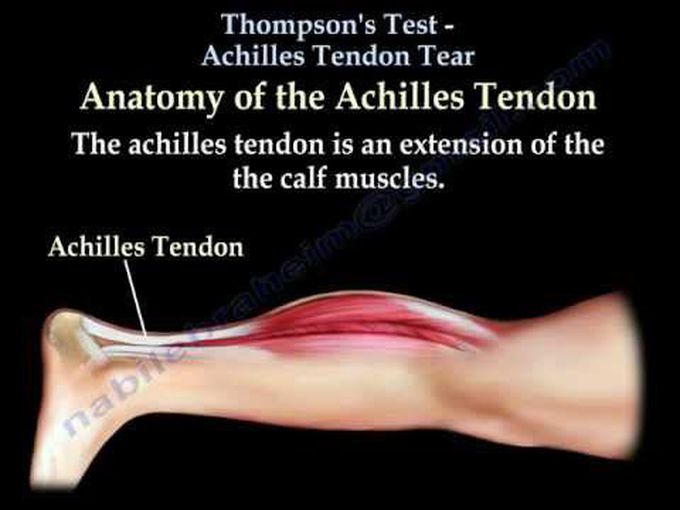 Thompson's Test Achilles Tendon Tear - Everything You Need To Know - Dr. Nabil Ebraheim