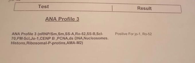 ANA profile result.. DDx?!!