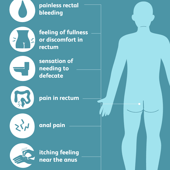 Piles symptoms - MEDizzy