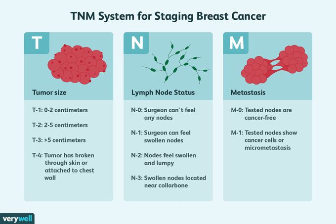 TNM system for staging brest cancer .
