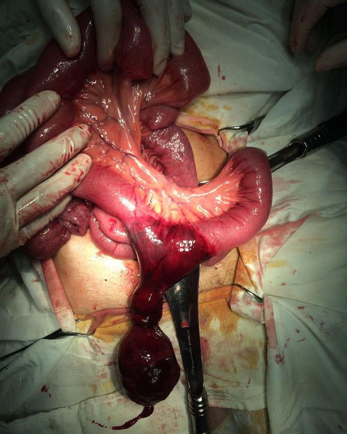 SPOT Diagnosis : What seems to be the diagnosis ? It also called "disease of two"...
