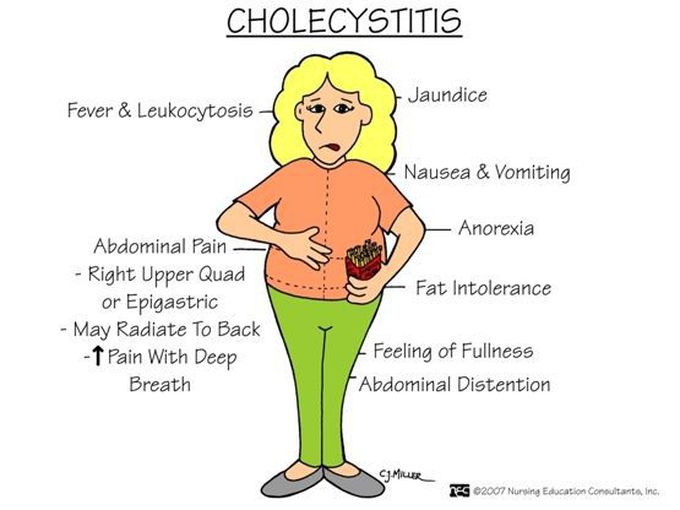 Cholecystitis | Nurse, Surgical nursing, Nursing school tips