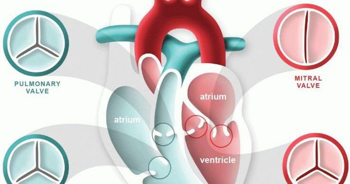 Heart valve disease or Valvular heart disease