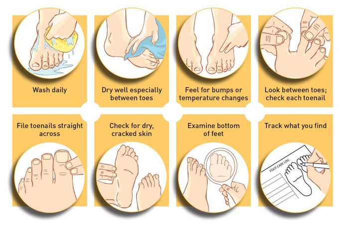 Treatment for Diabetic foot