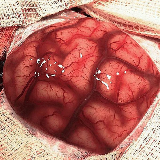 Frontal lobe
