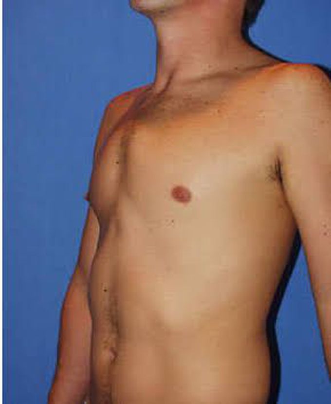 Diagnosis ?