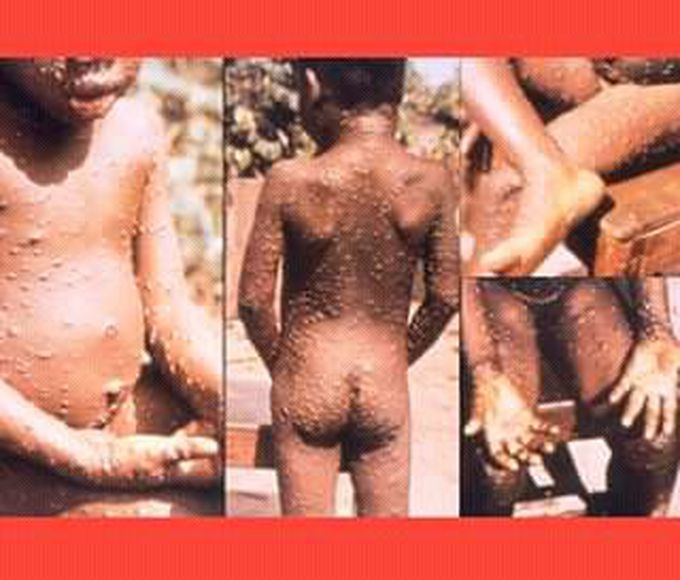 Please diagnosis and treatment