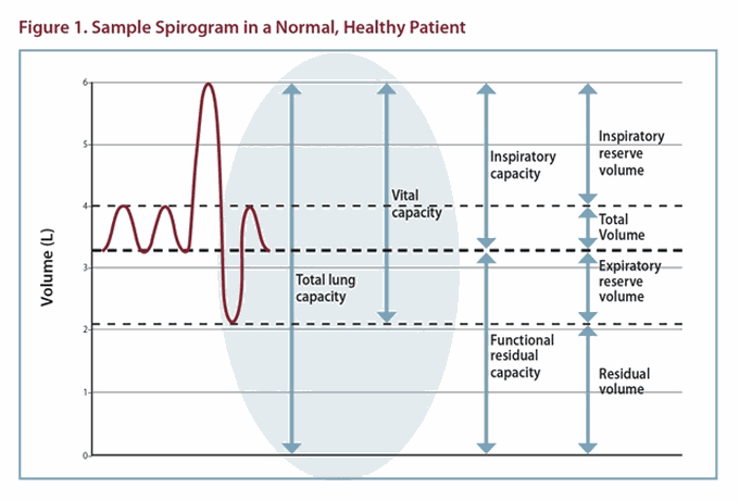 Normal Spirogram