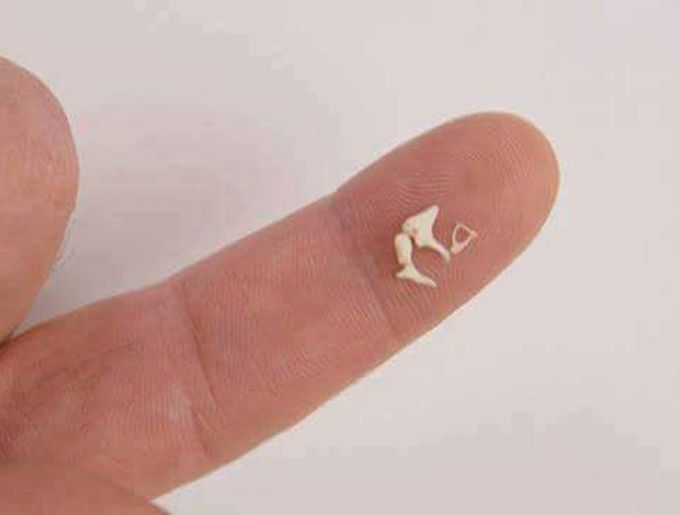 Ossicles of middle ear