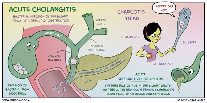 Acute cholangitis