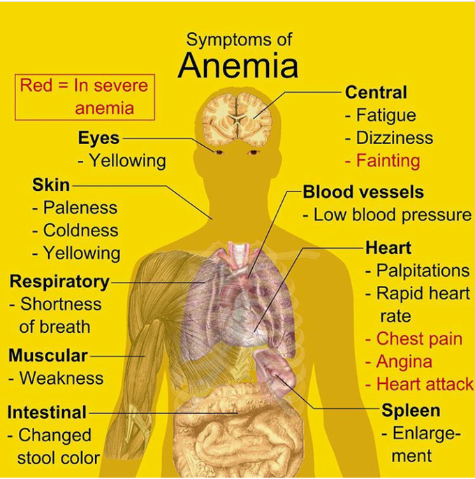 Symptoms Of Anemia Medizzy 3367