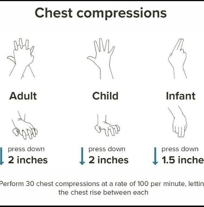 Chest compressions