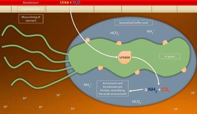 Epigastric pain and melena