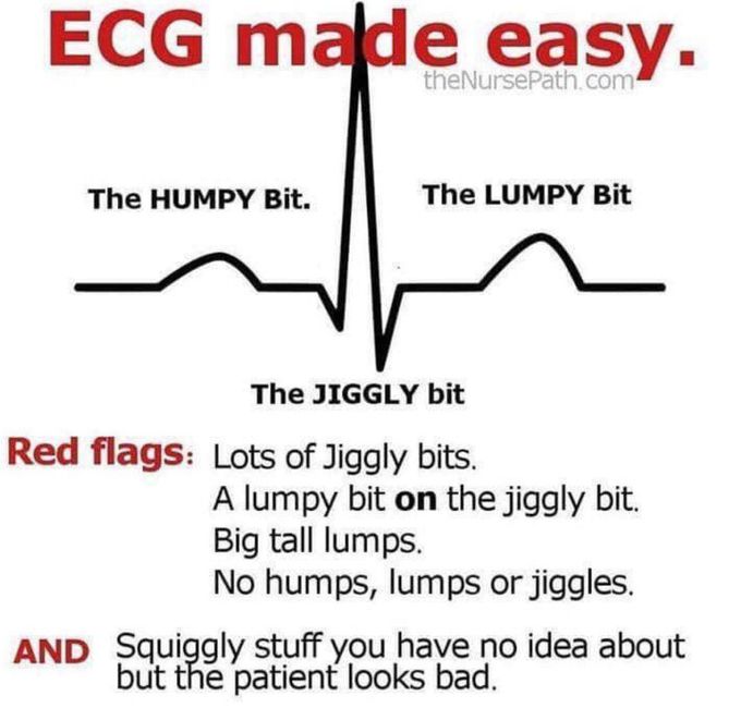 ECG Made Easy