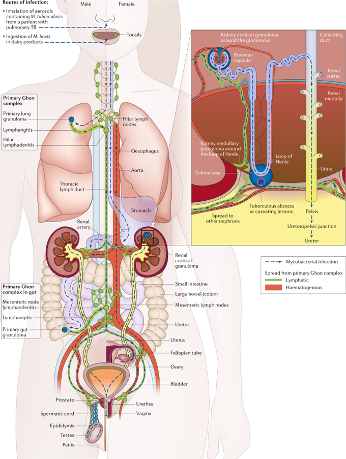 Bladder and Kidney Tuberculosis