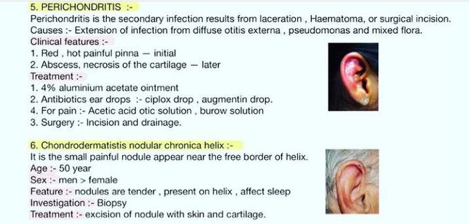 Pinna Pathologies