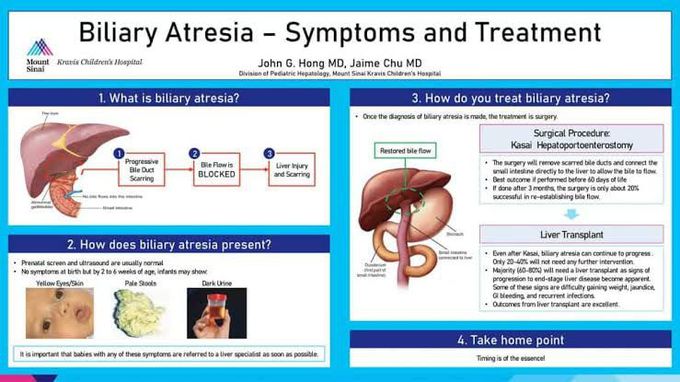 Biliary Atresia