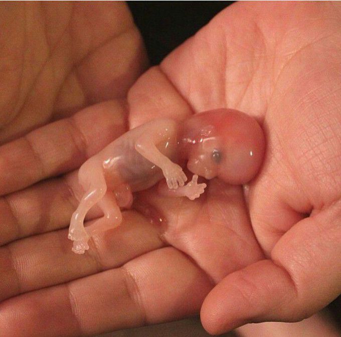 Fetus!