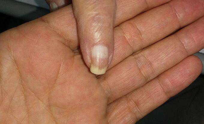 What is the diagnosis? And whats the ddx?