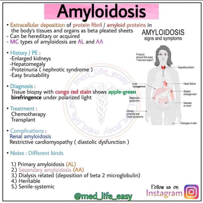 Amylidosis