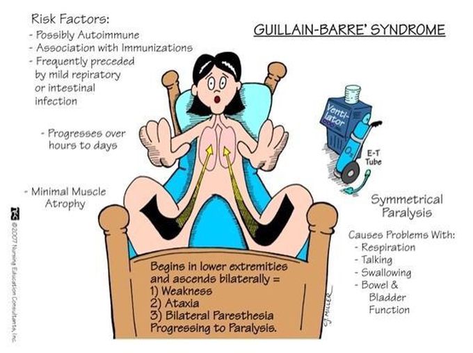 Guillain-Barre's Syndrome