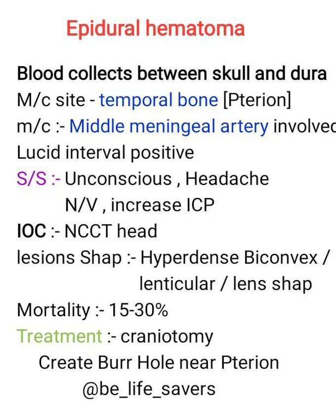 Epidural hematoma