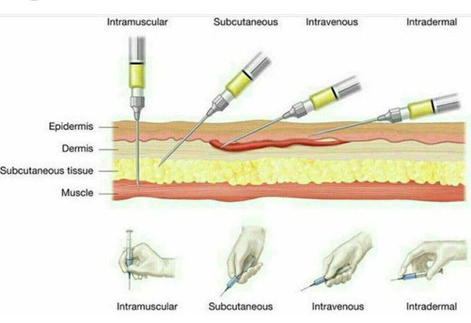 Different types of injection 💉