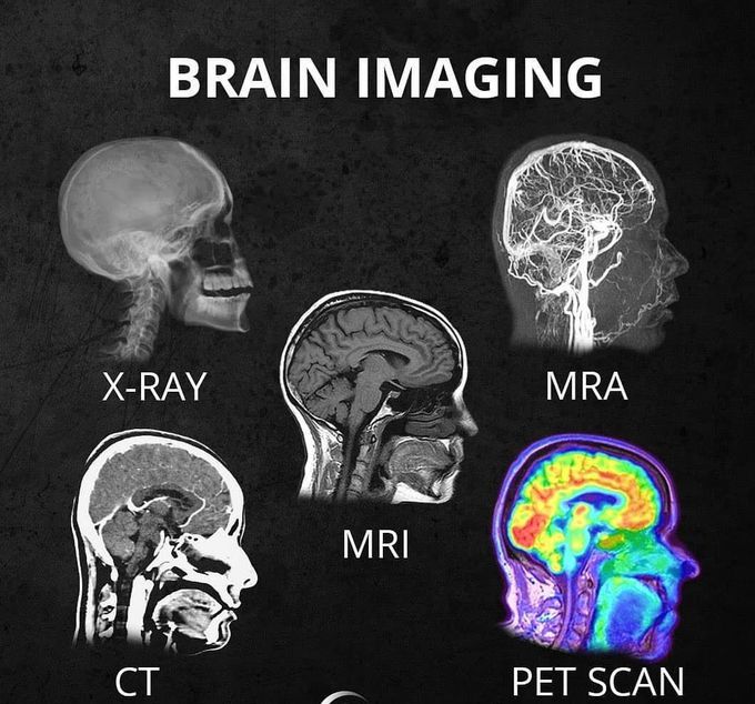 Differment type of brain images