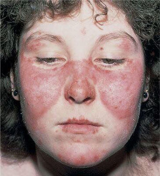 WHAT IS YOUR DIAGNOSIS ..??
