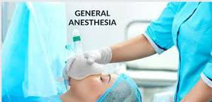 General anesthesia