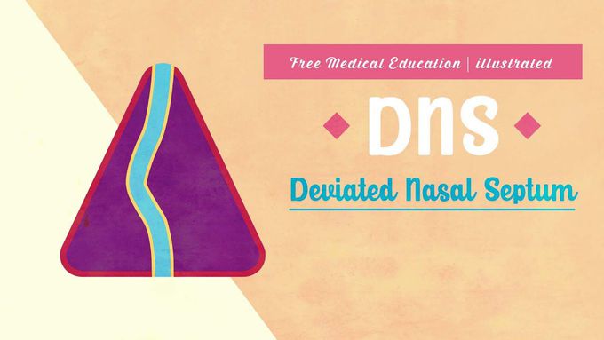 The Deviated Nasal Septum Explained