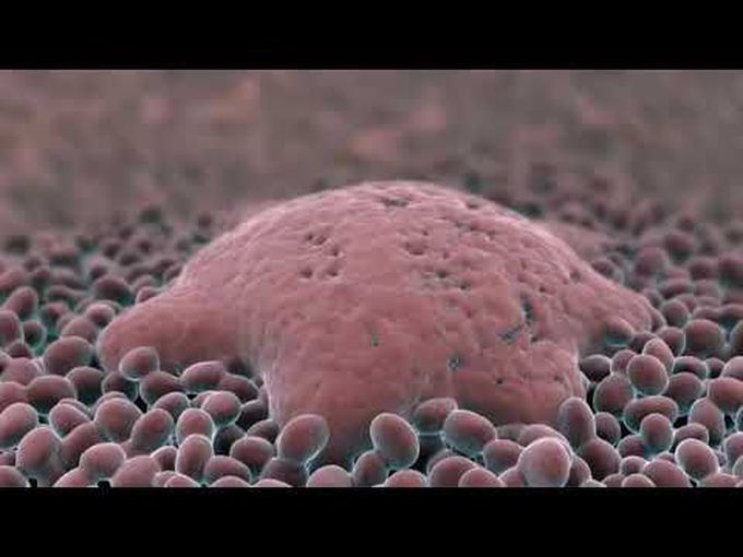 Fundamental Pathology of Adnexal Tumors