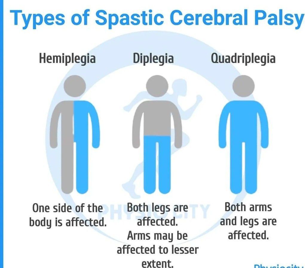 types-of-spastic-cp-medizzy