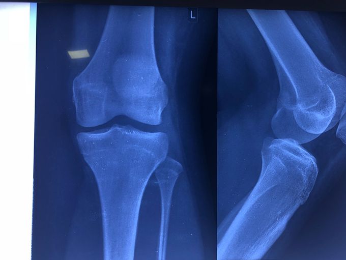 Orthopedic