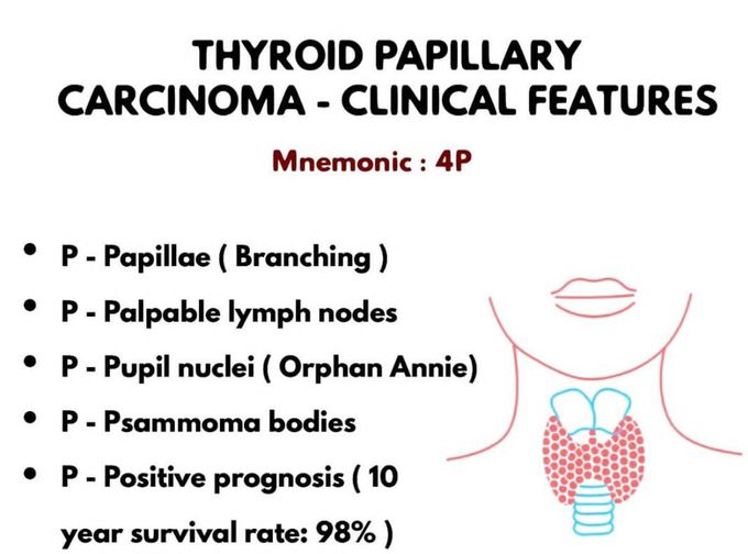 Thyroid Papillary Carcinoma