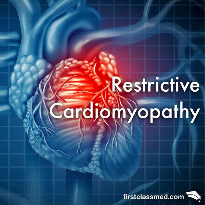 Restrictive Cardiomyopathy - The Heart that just doesn’t want to give in